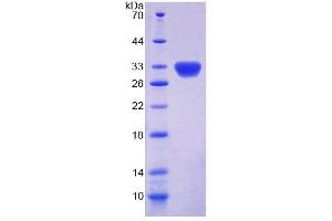 Image no. 1 for Dyskeratosis Congenita 1, Dyskerin (DKC1) (AA 298-509) protein (T7 tag,His tag) (ABIN6239095)
