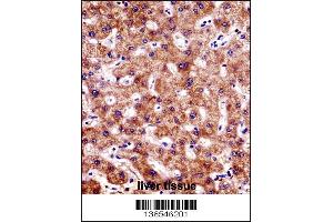Image no. 3 for anti-B-Cell CLL/lymphoma 7B (BCL7B) (AA 137-164), (C-Term) antibody (ABIN1536707)