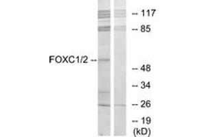 Image no. 1 for anti-Forkhead Box C1 (FOXC1) (AA 151-200) antibody (ABIN1533852)