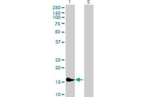 Image no. 1 for anti-HRAS-Like Suppressor 3 (PLA2G16) (AA 1-162) antibody (ABIN524565)