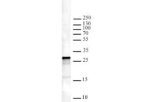 Image no. 1 for anti-Inhibitor of Growth Family, Member 5 (ING5) antibody (ABIN6972204)