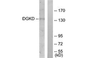 Image no. 1 for anti-Diacylglycerol Kinase, delta 130kDa (DGKD) (AA 41-90) antibody (ABIN1533935)