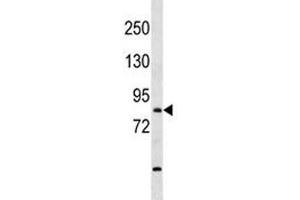 Image no. 2 for anti-T-Box Brain Gene 1 (TBR1) (AA 52-80) antibody (ABIN3029086)