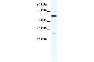 Image no. 3 for anti-Transcription Factor 7 (T-Cell Specific, HMG-Box) (TCF7) (Middle Region) antibody (ABIN2776021)