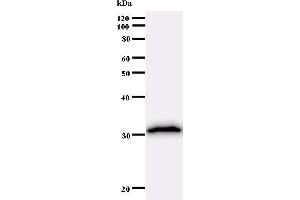 Western Blotting (WB) image for anti-Homeobox A7 (HOXA7) antibody (ABIN930984)