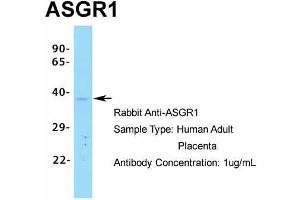 Image no. 9 for anti-Asialoglycoprotein Receptor 1 (ASGR1) (Middle Region) antibody (ABIN2778131)