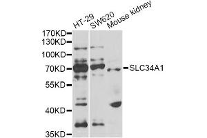 Image no. 3 for anti-Solute Carrier Family 34 (Type II Sodium/phosphate Contransporter), Member 1 (SLC34A1) antibody (ABIN2559971)