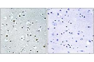 Image no. 1 for anti-Peroxisome Proliferator-Activated Receptor Gamma, Coactivator-Related 1 (PPRC1) (AA 1609-1658) antibody (ABIN1535161)