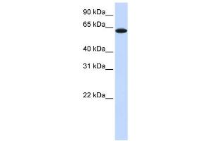 Image no. 1 for anti-Tyrosinase-Related Protein 1 (TYRP1) (Middle Region) antibody (ABIN635947)