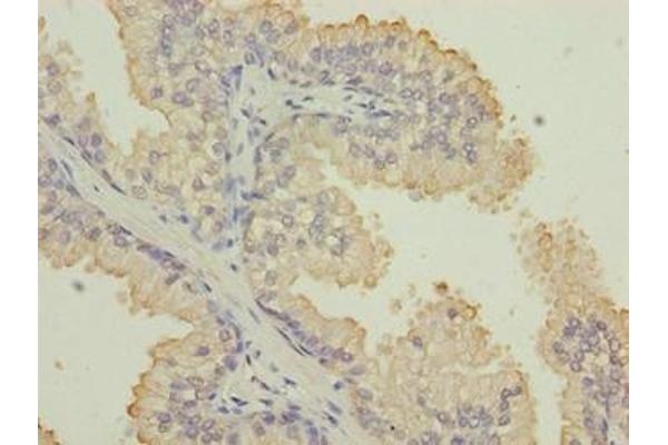 Keratin 33B anticorps  (AA 1-404)