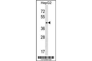 Image no. 1 for anti-Keratin 23 (KRT23) (AA 141-170) antibody (ABIN1537856)