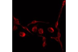 Image no. 1 for anti-Transforming Growth Factor, beta 3 (TGFB3) antibody (ABIN6265548)