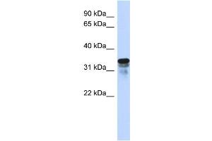 Image no. 1 for anti-Regulator of Microtubule Dynamics 1 (RMDN1) (N-Term) antibody (ABIN2782553)