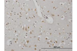 Image no. 2 for anti-Cyclin Dependent Kinase Like 2 (CDKL2) (AA 394-493) antibody (ABIN563901)