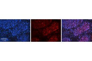 Image no. 4 for anti-Histone Deacetylase 2 (HDAC2) (Middle Region) antibody (ABIN2777505)