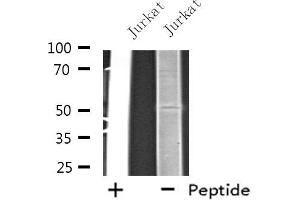 Image no. 1 for anti-Eukaryotic Translation Initiation Factor 2B, Subunit 3 Gamma, 58kDa (EIF2B3) antibody (ABIN6258150)