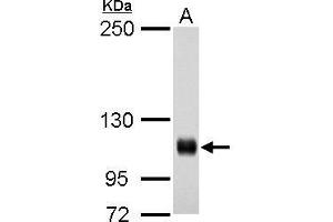 WB Image Rb antibody detects Rb protein by western blot analysis.