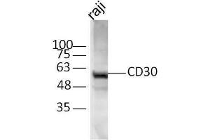 Image no. 3 for anti-Tumor Necrosis Factor Receptor Superfamily, Member 8 (TNFRSF8) (AA 131-230) antibody (ABIN741090)