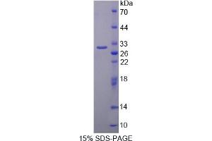 Image no. 1 for SFRS Protein Kinase 2 (SRPK2) (AA 380-617) protein (T7 tag,His tag) (ABIN6238136)
