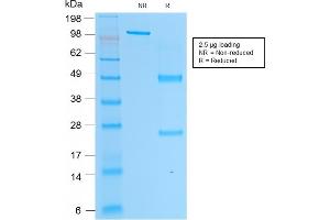 Image no. 1 for anti-Acid Phosphatase, Prostate (ACPP) antibody (ABIN6940395)