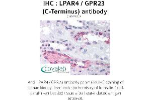 Image no. 1 for anti-Lysophosphatidic Acid Receptor 4 (LPAR4) (C-Term) antibody (ABIN1736524)