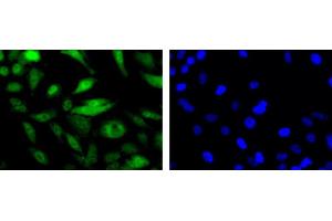 Image no. 4 for anti-MRE11 Meiotic Recombination 11 Homolog A (S. Cerevisiae) (MRE11A) antibody (ABIN363310)
