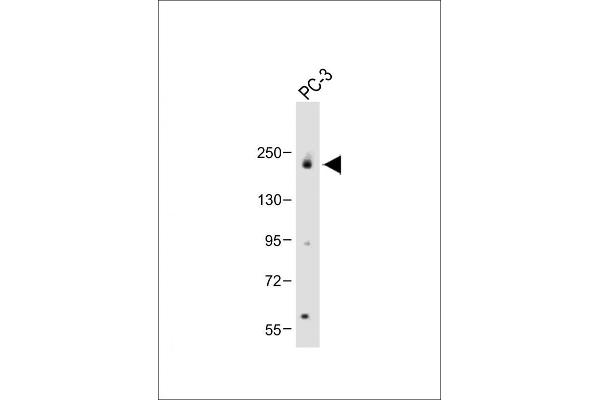 SPAG9 抗体  (N-Term)