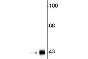 Image no. 2 for anti-Actin, alpha 1, Skeletal Muscle (ACTA1) antibody (ABIN361349)