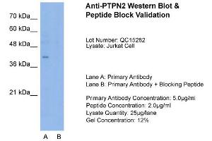 Image no. 2 for anti-Protein tyrosine Phosphatase, Non-Receptor Type 2 (PTPN2) (N-Term) antibody (ABIN2782194)
