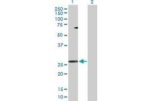 Image no. 2 for anti-Protein Phosphatase 3, Regulatory Subunit B, alpha (PPP3R1) (AA 1-170) antibody (ABIN519134)