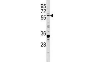 Image no. 3 for anti-Early Growth Response 1 (EGR1) (AA 9-37) antibody (ABIN3028632)