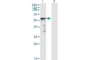 Western Blot analysis of SESN2 expression in transfected 293T cell line by SESN2 monoclonal antibody (M01), clone 1A12.