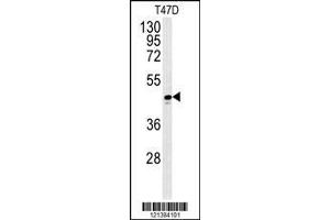 anti-Alcohol Dehydrogenase 1C (Class I), gamma Polypeptide (ADH1C) (AA 231-260) antibody