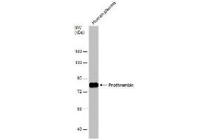 Image no. 3 for anti-Coagulation Factor II (thrombin) (F2) (N-Term) antibody (ABIN2854967)