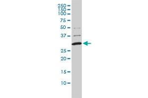 Image no. 1 for anti-Catechol-O-Methyltransferase (COMT) (AA 1-182) antibody (ABIN560435)