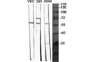 Image no. 2 for anti-Bone Morphogenetic Protein 5 (BMP5) (Internal Region) antibody (ABIN3183528)