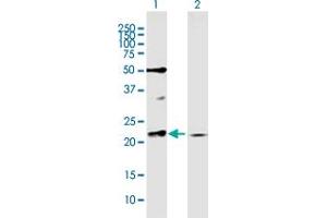 Image no. 1 for anti-RAB11A, Member RAS Oncogene Family (RAB11A) (AA 1-216) antibody (ABIN522201)