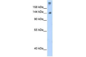 Image no. 4 for anti-Splicing Factor 3b, Subunit 1, 155kDa (SF3B1) (N-Term) antibody (ABIN2778700)
