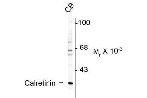 Image no. 1 for anti-Calbindin 2 (CALB2) antibody (ABIN361372)
