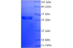 Image no. 1 for BCL2-Like 1 (BCL2L1) (AA 1-209), (partial) protein (His-SUMO Tag) (ABIN5709127)