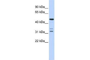 Image no. 1 for anti-HtrA Serine Peptidase 4 (HTRA4) (Middle Region) antibody (ABIN2774114)