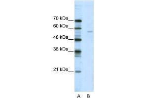 Image no. 1 for anti-ELK1, Member of ETS Oncogene Family (ELK1) (N-Term) antibody (ABIN2780662)