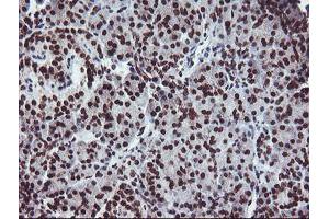 Image no. 11 for anti-Fragile X Mental Retardation 1 (FMR1) (AA 36-279) antibody (ABIN1491454)