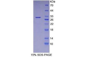 Image no. 1 for DNA Fragmentation Factor, 40kDa, beta Polypeptide (Caspase-Activated DNase) (DFFB) (AA 87-323) protein (His tag) (ABIN1879297)