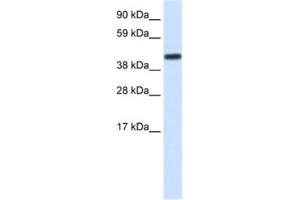 Image no. 1 for anti-CCR4-NOT Transcription Complex, Subunit 2 (CNOT2) antibody (ABIN2460364)