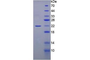SDS-PAGE (SDS) image for Gremlin 1 (GREM1) (Active) protein (ABIN6119725)