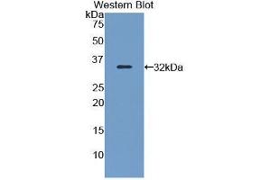 Image no. 1 for anti-Filamin B, beta (FLNB) (AA 1175-1457) antibody (ABIN1176408)