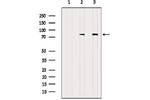 alpha Adducin antibody