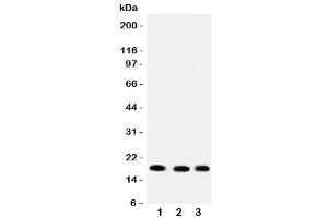 Image no. 2 for anti-Ubiquitin-Conjugating Enzyme E2I (UBE2I) (C-Term) antibody (ABIN3029436)