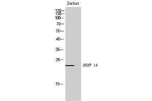 Image no. 1 for anti-A Kinase (PRKA) Anchor Protein 14 (AKAP14) (N-Term) antibody (ABIN3183219)